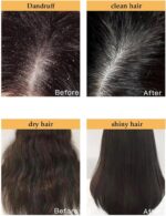 MAXFIT SAKURA JAPANESE SHAMPOO – 300ml شامبو ساكورا الياباني لنمو الشعر ومنع تساقط الشعر وازالة القشرة – 300 مل - الصورة 3