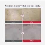 ⁦MEDICUBE- مقشر الجسم الأحمر لعلاج حب الشباب من ميديكوب - 110 مل⁩ - الصورة ⁦4⁩