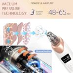 ⁦BLACKHEAD REMOVER- جهاز شفط لإزالة الرؤوس السوداء وتنظيف المسام، أداة كهربائية لعلاج حب الشباب، قابلة لإعادة الشحن عبر منفذ USB⁩ - الصورة ⁦3⁩